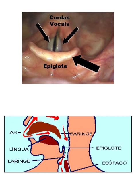 glote e epiglote